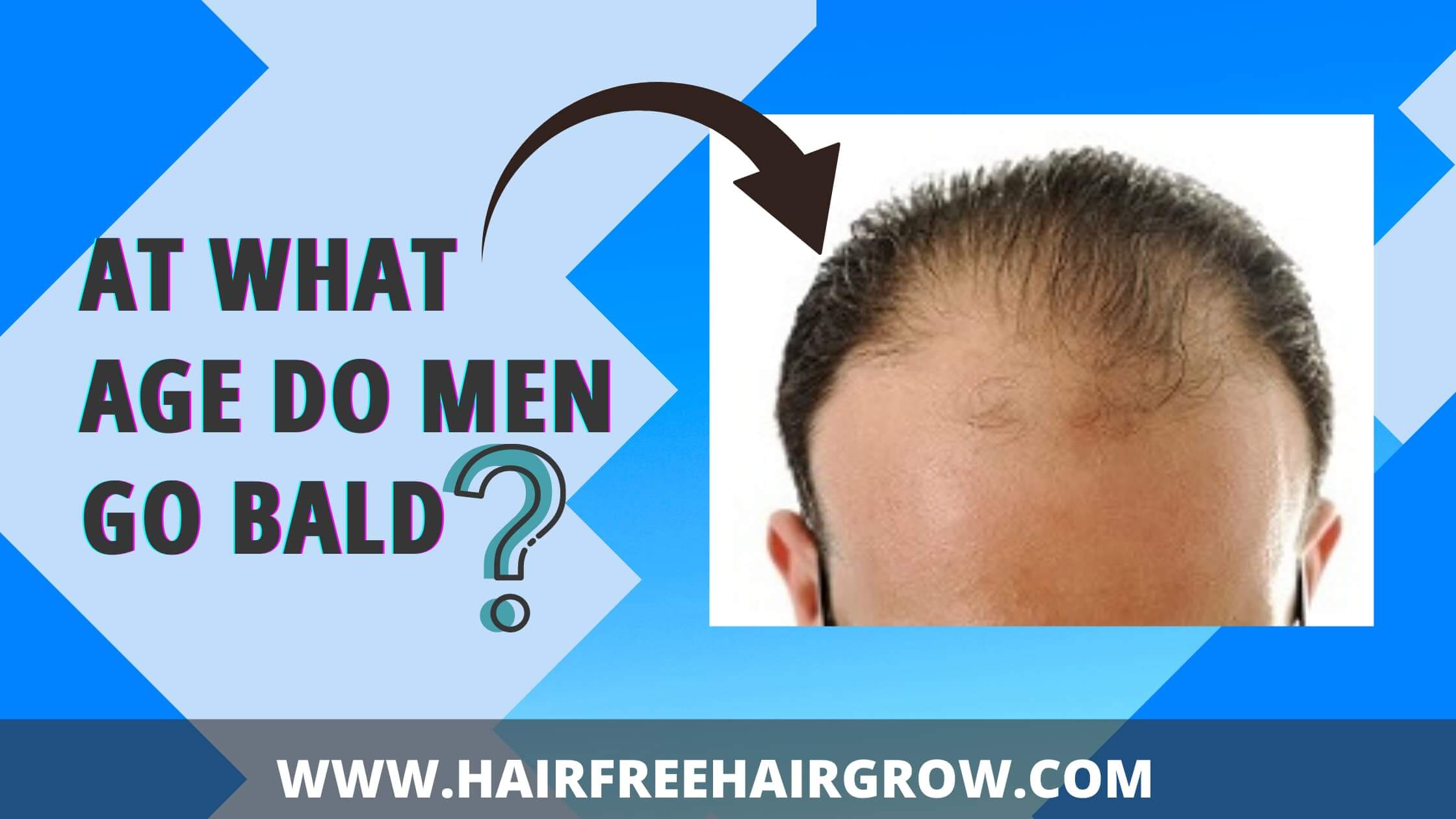 At what age do men go bald