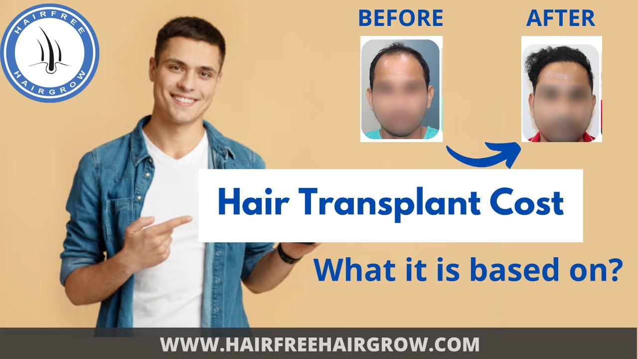 Hair transplant cost