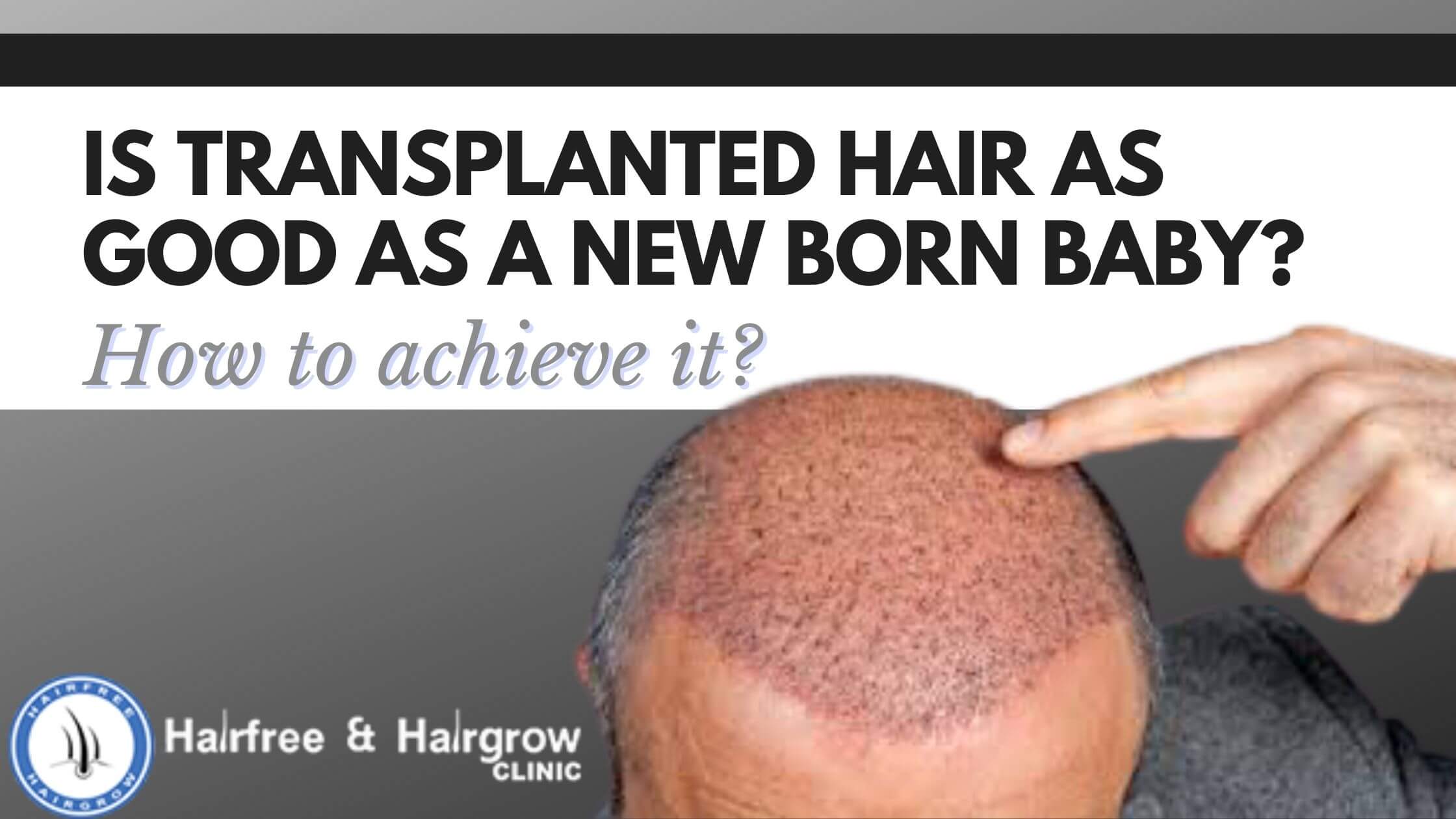 Transplanted hair