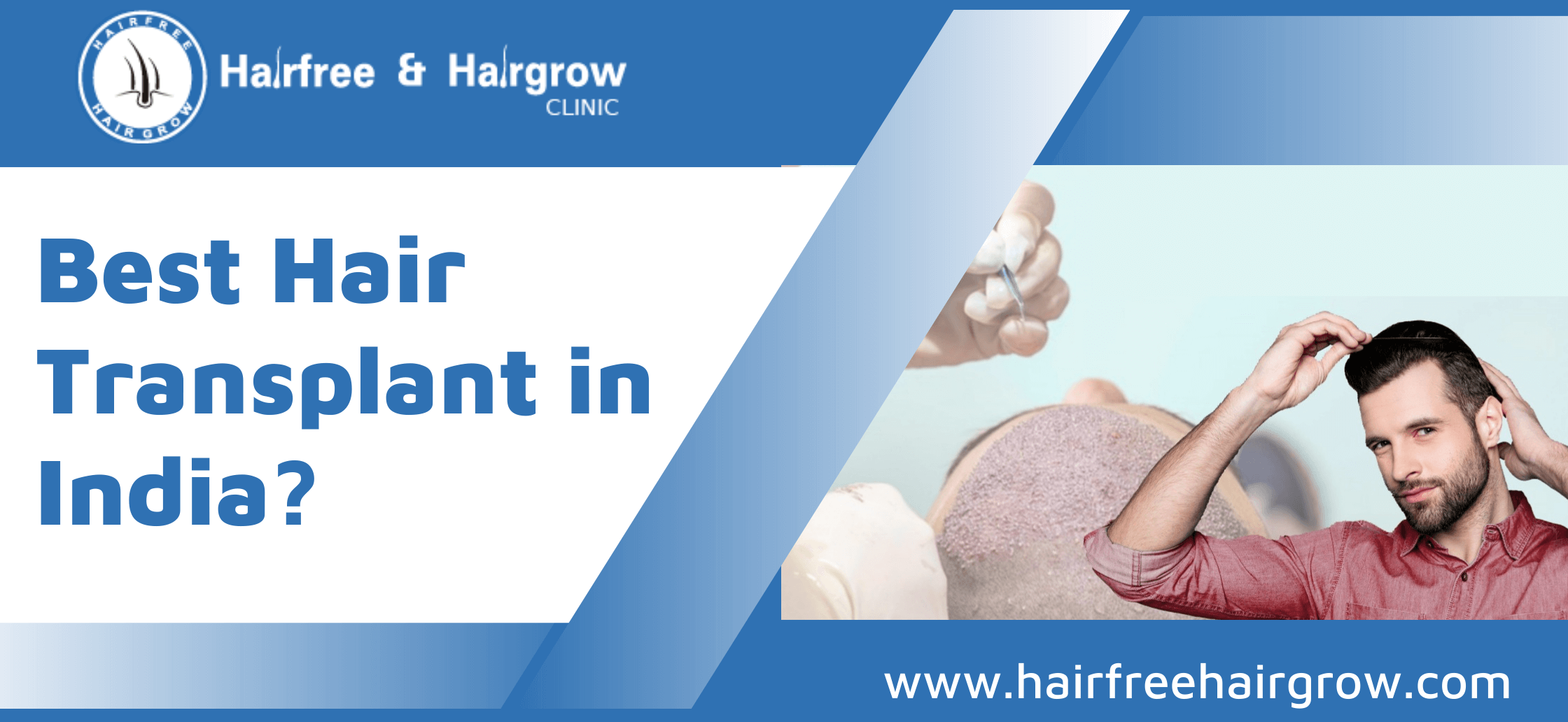 Best Hair Transplant in India