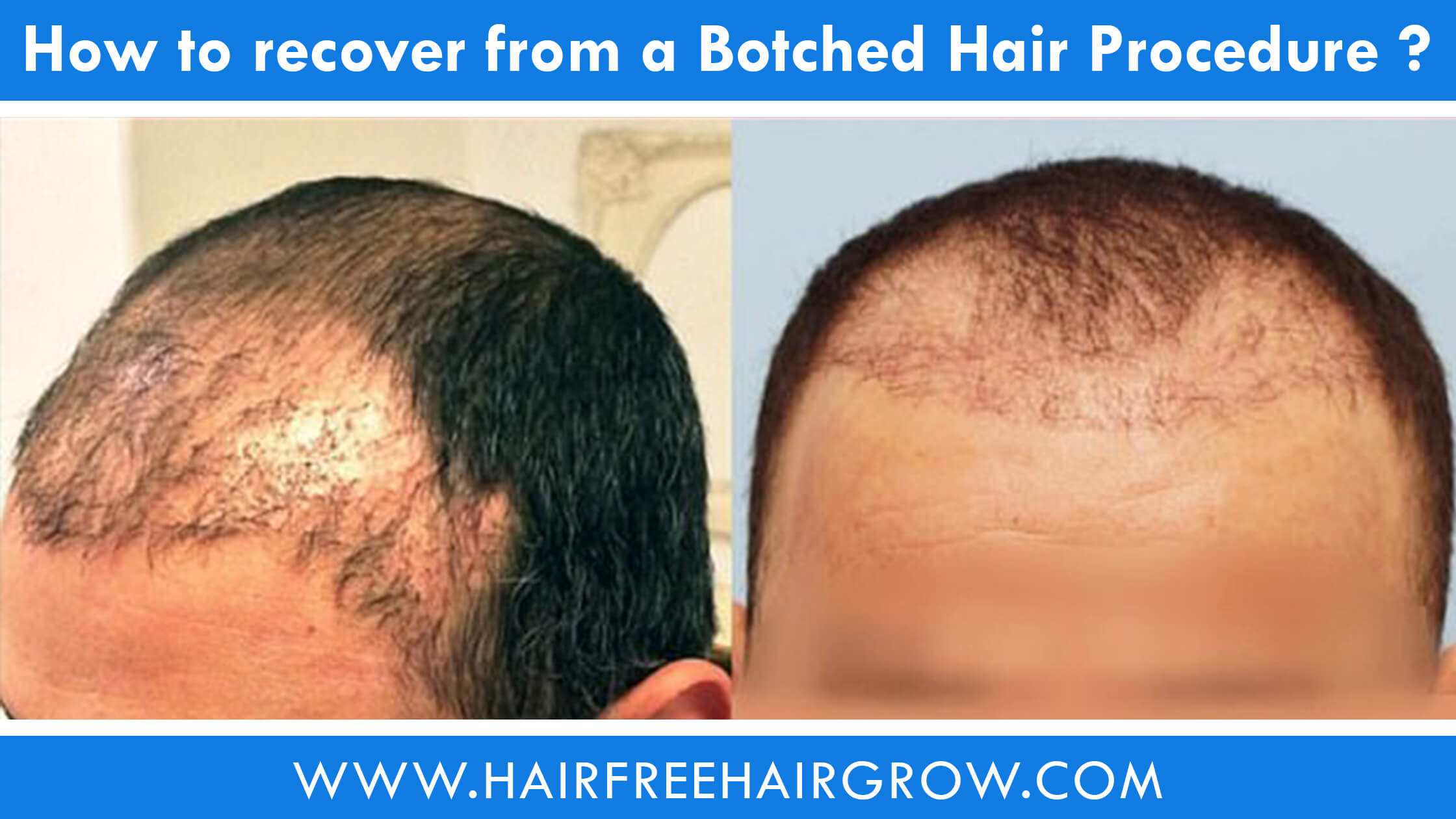botched_hair_procedure