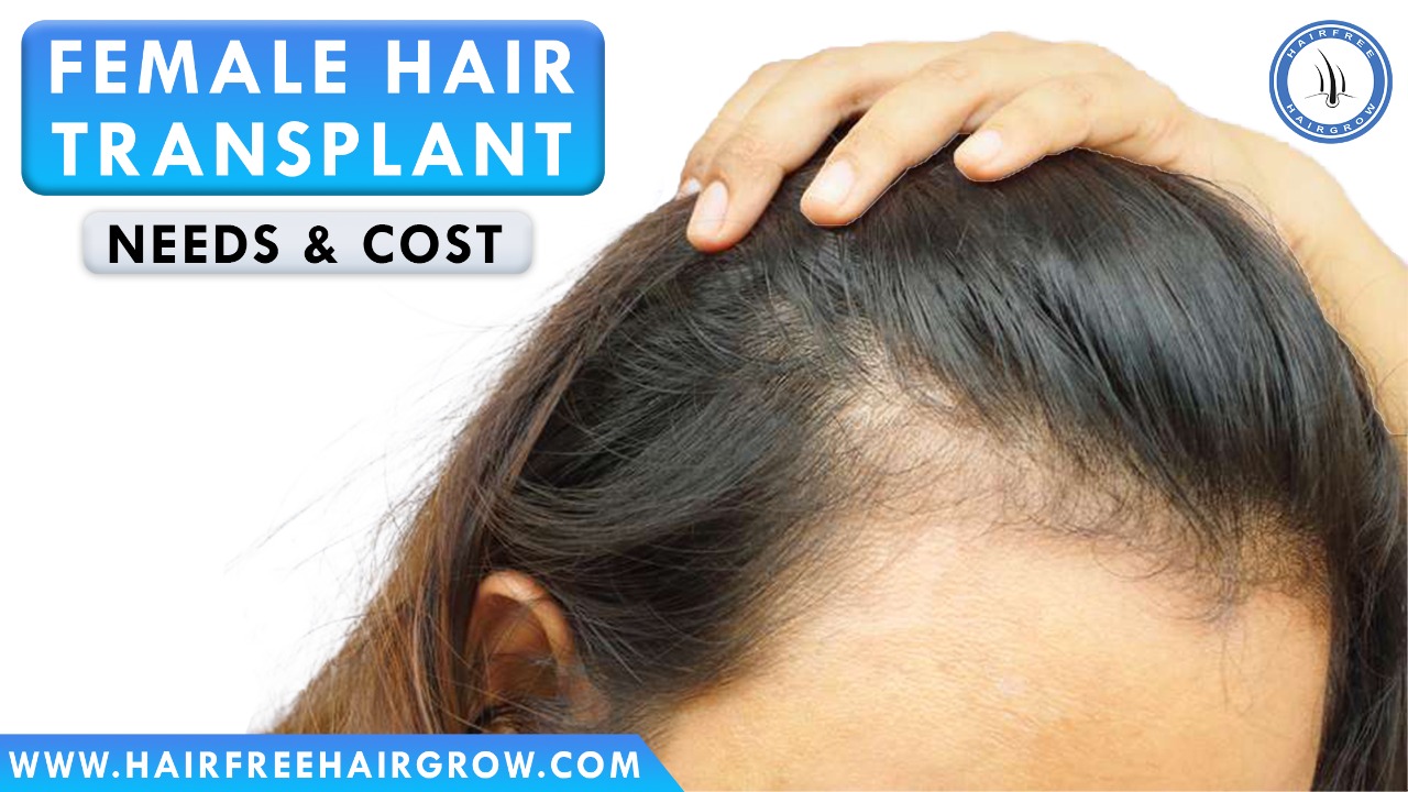 Female Hair Transplant