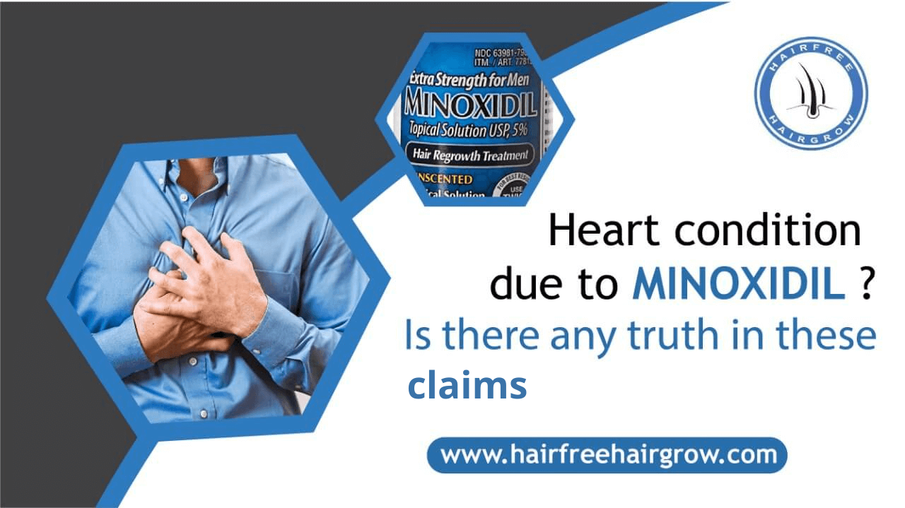 minoxidil and heart condition