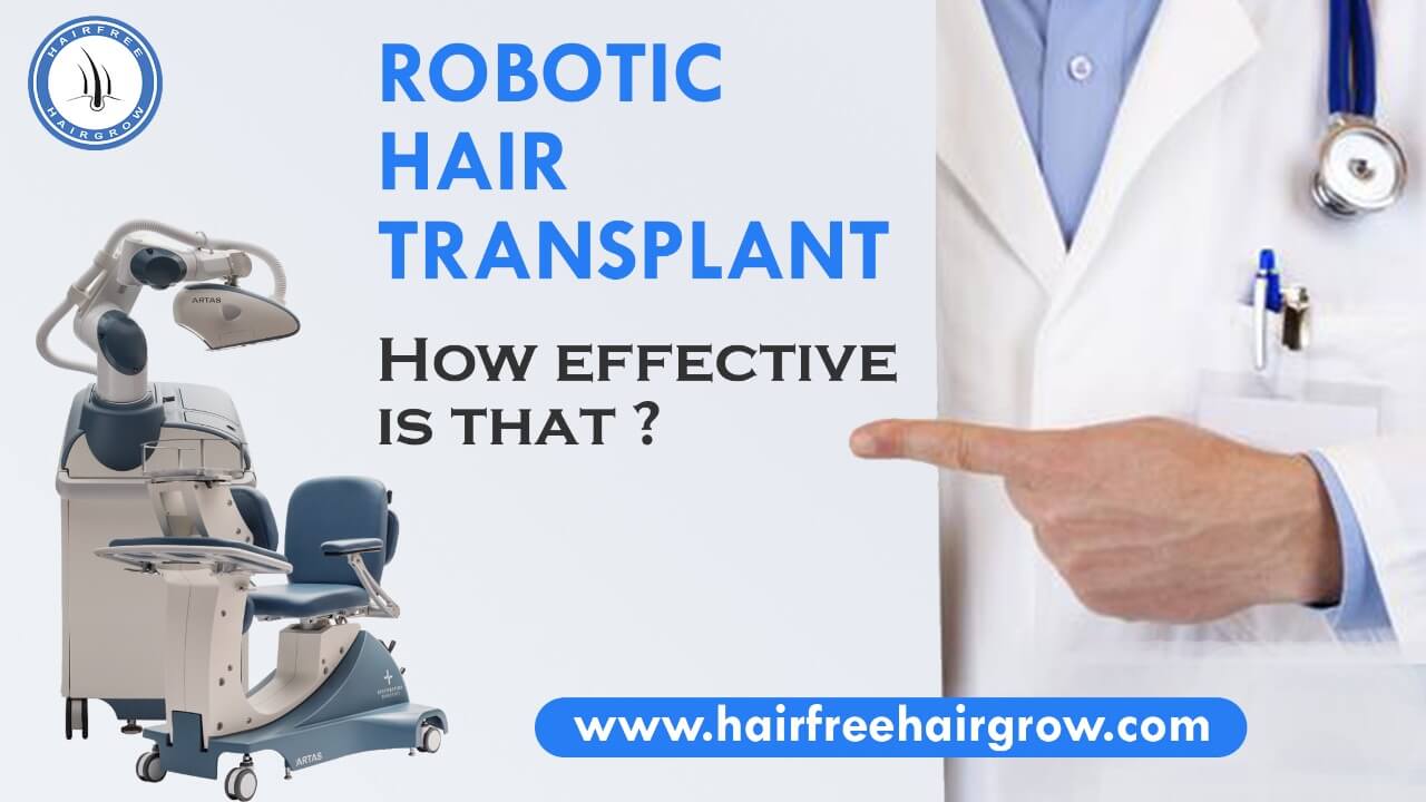robotic hair transplant