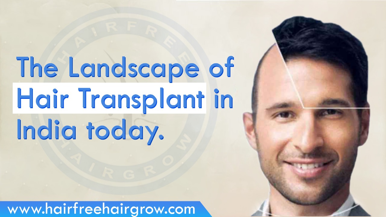 the landscape of hair transplant