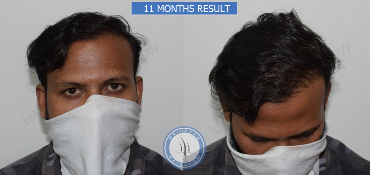 11 Months Results 